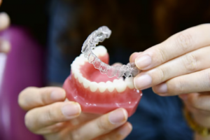 Unveiling the Magic of Invisalign in Boca Raton with Goldenberg Orthodontics