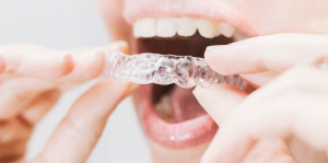 Why Choose Invisible Braces Over Traditional Metal Braces?